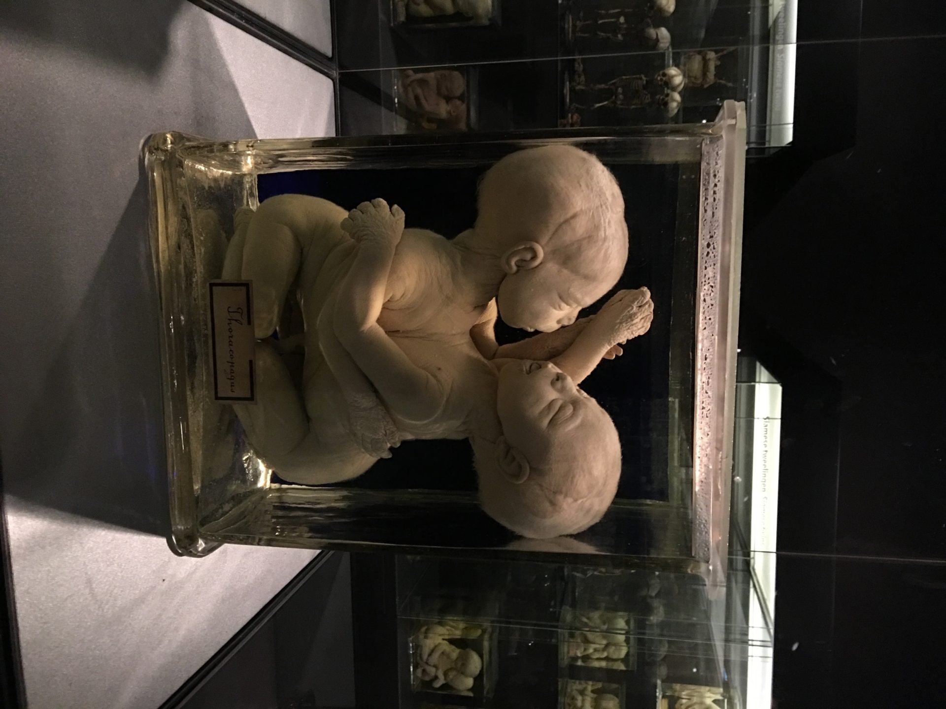 Vrolik Museum, Amsterdam (by Gabriele Maggi) (6).JPG